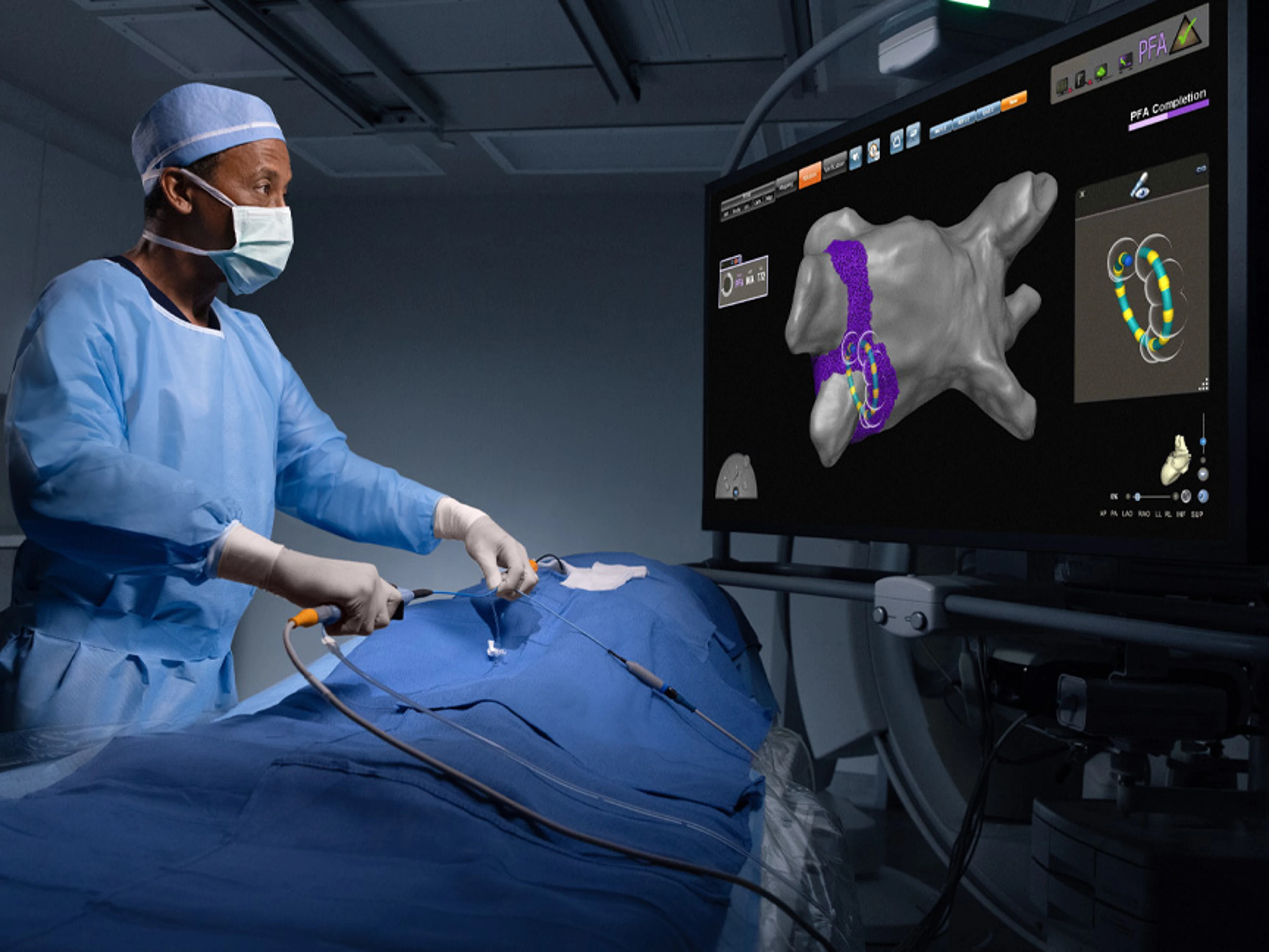 Tratamento Inédito para Fibrilação Atrial com Campo Pulsado Chega ao Espírito Santo